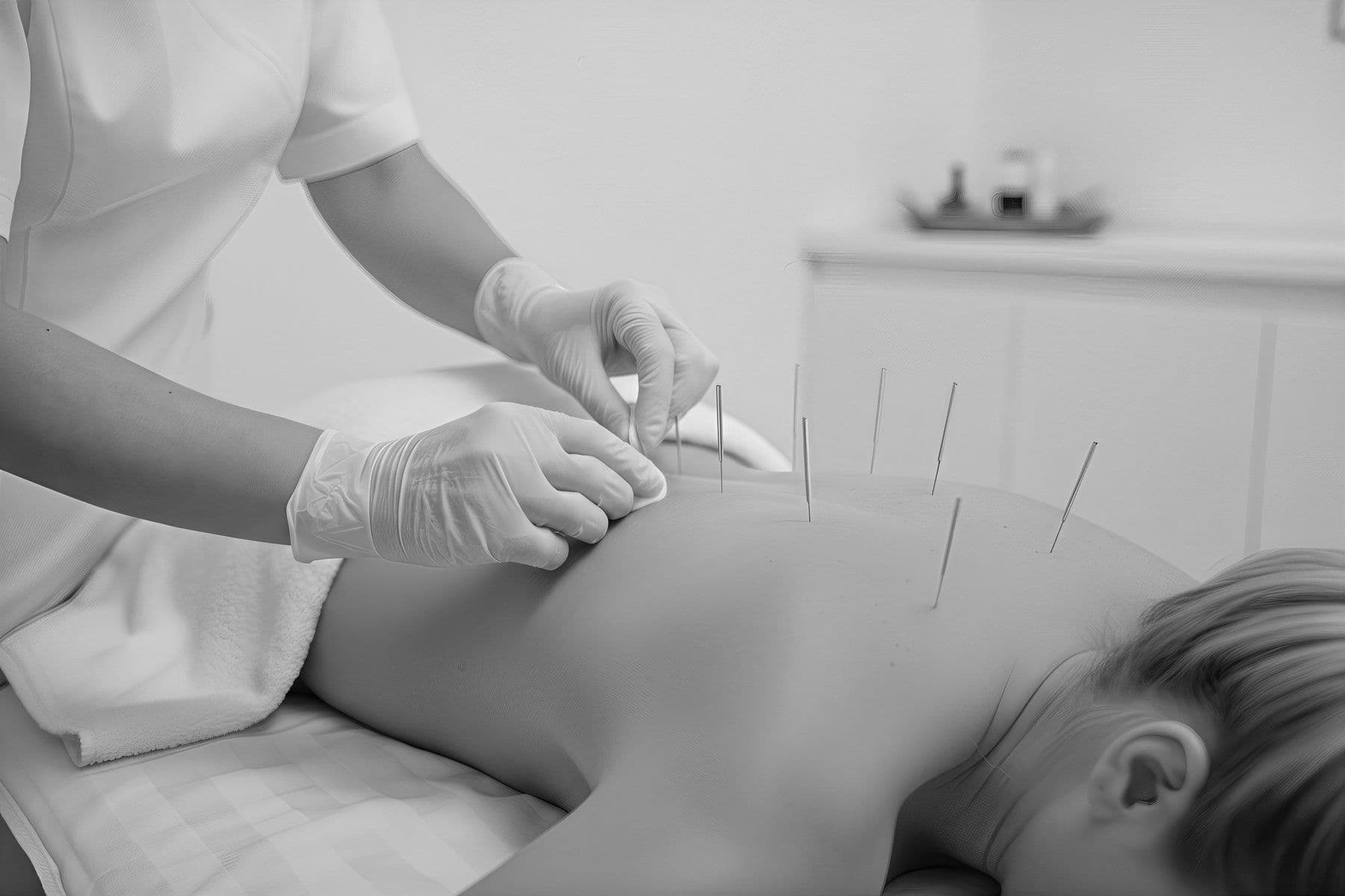 Συνεδρία ξηράς βελόνας (dry needling) στην πλάτη στο Physiowave